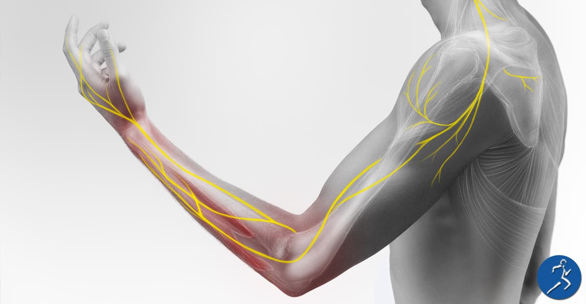 Anatomical illustration highlighting the nerve pathways from the shoulder through the forearm and hand, the areas addressed in Aero Performance’s nerve pain and neuro rehab treatment in Coralville, Iowa